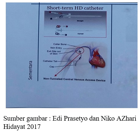 gambar leo 2