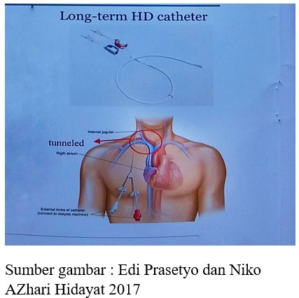 gambar leo 3